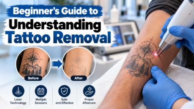 Tattoo Removal